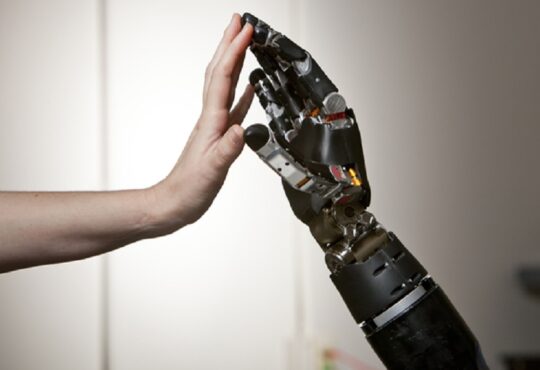 What Is The Future of Prosthetics In Bionic Limbs